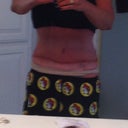 This is how you hide a scar after being on the beach for a few days!  lol