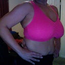 front view pre op