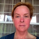Day 5...1st thing in the morning:  Still VERY red but I feel like venturing out today!