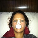 Night of surgery, after icing all day, not very swollen or bruised.
