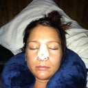Morning after surgery. Tiny bit swollen