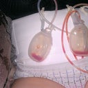 Post op Day 3 no more pain pump but still have 3 drains