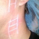 The test area on my face and neck was completed using various settings and checked 15 minutes later for the expected results.
