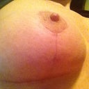 about 3 weeks after tape came off.