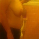 Side View Pre-Op