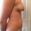 Puffy all over!