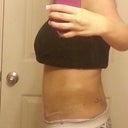 night time super swollen.. wearing my tape! 04-24-13