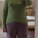28 days post-op