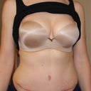 My boobs are high and full!  YAY!  8 weeks post op.  Love this bra!