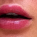 1 hr after, still swollen but looking better?