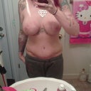 Almost 11 weeks out. Front view. Yeah....should've done Lipo. Too bad he didnt recommend it. And my boobs look saggy again =/