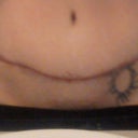 This was my scar and previous tattoo that i had covered.