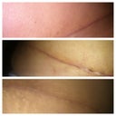Scar