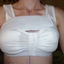 Post-op with the surgical bra!