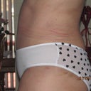 24 days post op