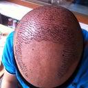 1 day after