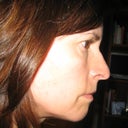 For comparison purposes, here is a picture from the same angle, with the same expression taken today, with no makeup.  I am posting another from the day after the procedure that is from the same distance.  You can see how severe the swelling was