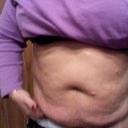 PreOp 1/10/12