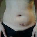 10 days after