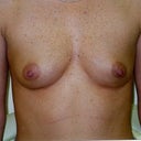 1999 Before