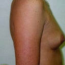 1999 Before