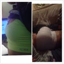 Sneak peak. The morning of and a few hours after I left the hospital!