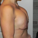 3 weeks post off