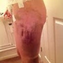 Other leg!!!