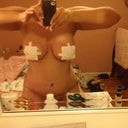 7 weeks post op. belly and hips still swollen