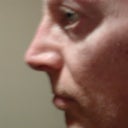 My newly sculpted nose at 31 days post-op.