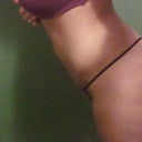 1st Tummy Tuck performed....my belly button was always inflamed