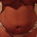 1 Week Post Op- Front