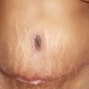 Front today is exactly 1 month