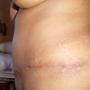 Left side, love my left side, 1 month