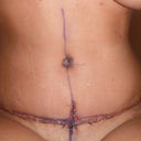 new belly button full of glue