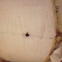 My scar is nice and low