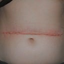 Four weeks after surgery.