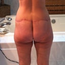 Almost 4 months after LBL