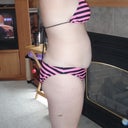 Right Side view 3 days before TT