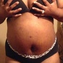 Today I'm 2 weeks postoperative TT 1/3/2013 still a lil swollen.