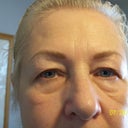 6 weeks after final touchup