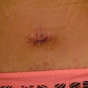 Belly button I think the brown around there is the glue and stuff still on there