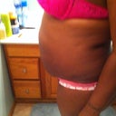 pre-op side view