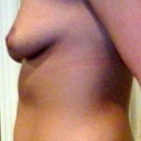 Breast and tummy from left