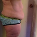 Side view.
