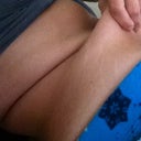 ugly flab...will be gone in 2 weeks!
