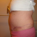 Week 11 - I was too depresed to take week 10, but week 11  is getting better