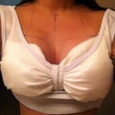 3 day post op