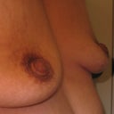 Side. After 6 months of Op.