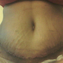 17 days po 10/01/12  still very happy!!!
